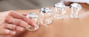 Cupping Cupping