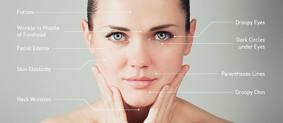 Botox vs acupuncture Botox vs acupuncture