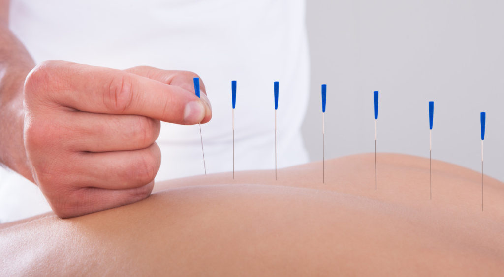 acupuncture treatment acupuncture treatment
